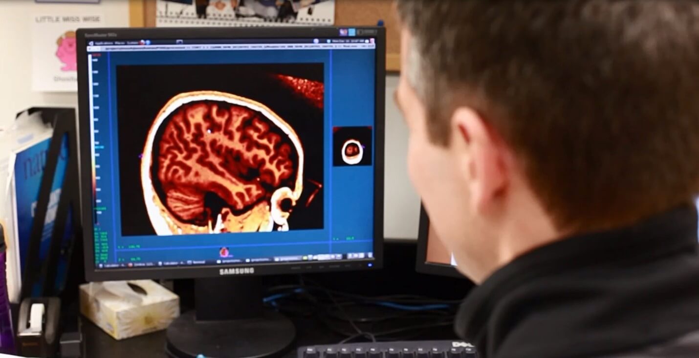 A person views a brain scan image displayed on a computer monitor in an office or lab setting. The screen shows a detailed cross-section of a human brain.